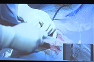 4TS Top to Toe Transcatheter Solutions Conference - 2016 Gallery